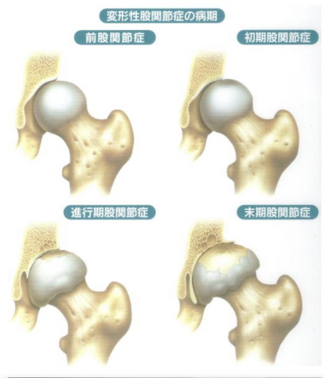 股関節